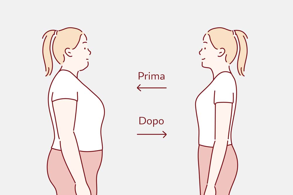 Dieta chetogenica prima e dopo Dieta chetogenica prima e dopo
